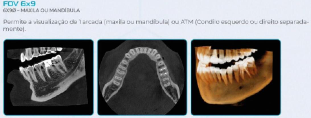 Eagle Edge Linha One - Dabi Atlante