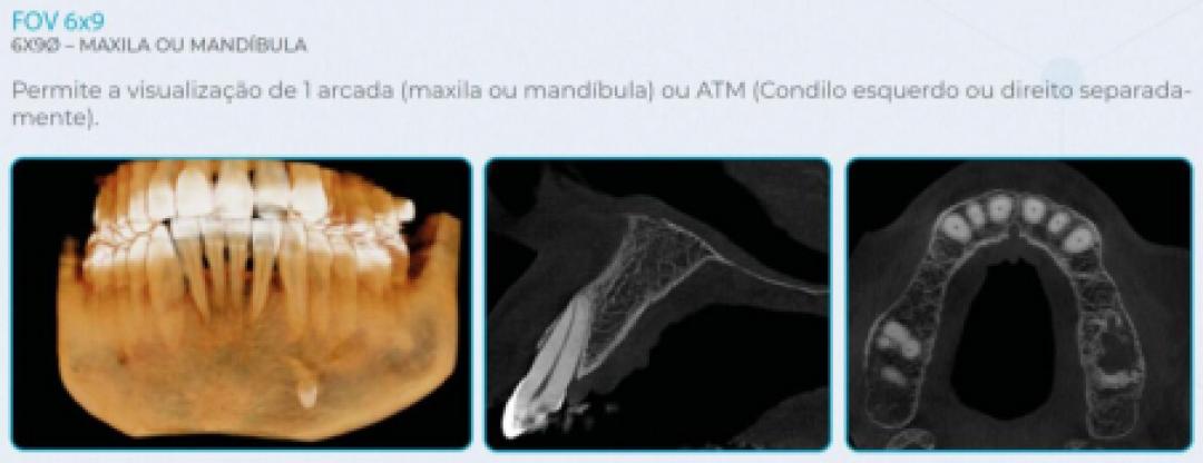 Eagle Edge 0.2 FS Linha Pro - Dabi Atlante