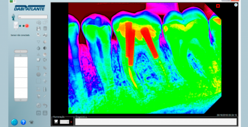 Eagle S T1 - Dabi Atlante