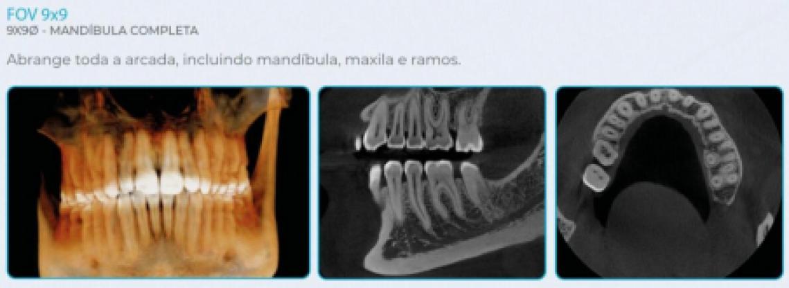 Eagle Edge 0.2 FS Linha Pro - Dabi Atlante