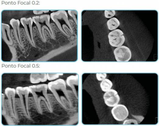 Eagle Edge 0.2 FS Linha Pro - Dabi Atlante