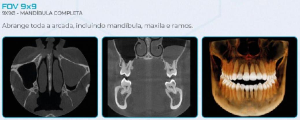 Eagle Edge Linha One - Dabi Atlante