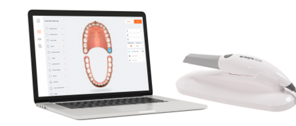 Eagle IOS Scanner Intraoral - Dabi Atlante