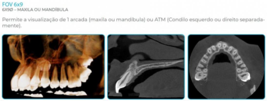 Eagle Edge Linha Pro - Dabi Atlante